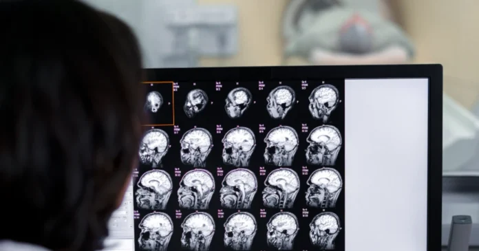 El cerebro fija temprano la zona que integra visión, memoria y consciencia, revela un estudio. Foto: Freepik IA
