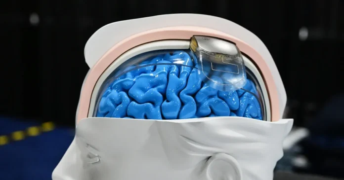 Investigadores prueban interfaces cerebro-ordenador capaces de interpretar señales neuronales para asistir a personas con parálisis o enfermedades neurológicas. Foto: Tomada de X